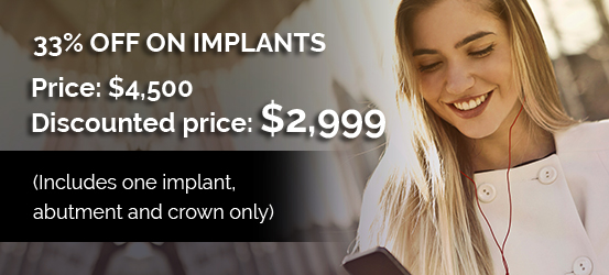 33% OFF ON IMPLANTS